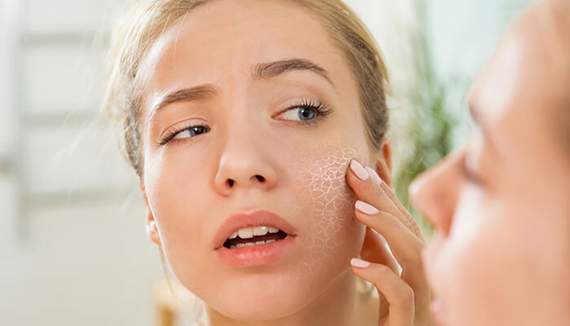 dry-skin-problems-and-solutions